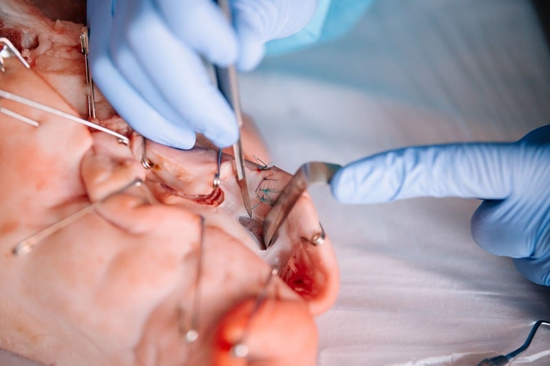 Detail hands-on – sutura tkáně pod chirurgickým vedením